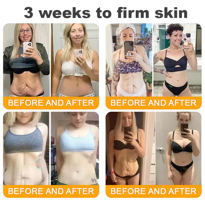 💐🌟💐Made and Shipped from USA ✨ LOVILDS™ Bee Venom Skin Restoration Cream 🔥 LAST DAY 80% OFF