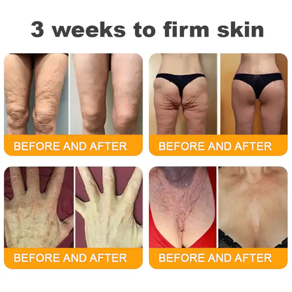 💐🌟💐Made and Shipped from USA ✨ LOVILDS™ Bee Venom Skin Restoration Cream 🔥 LAST DAY 80% OFF