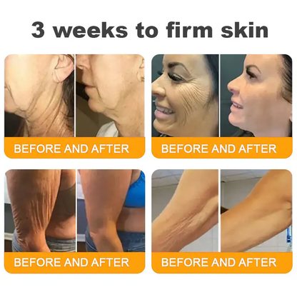 💐🌟💐Made and Shipped from USA ✨ LOVILDS™ Bee Venom Skin Restoration Cream 🔥 LAST DAY 80% OFF