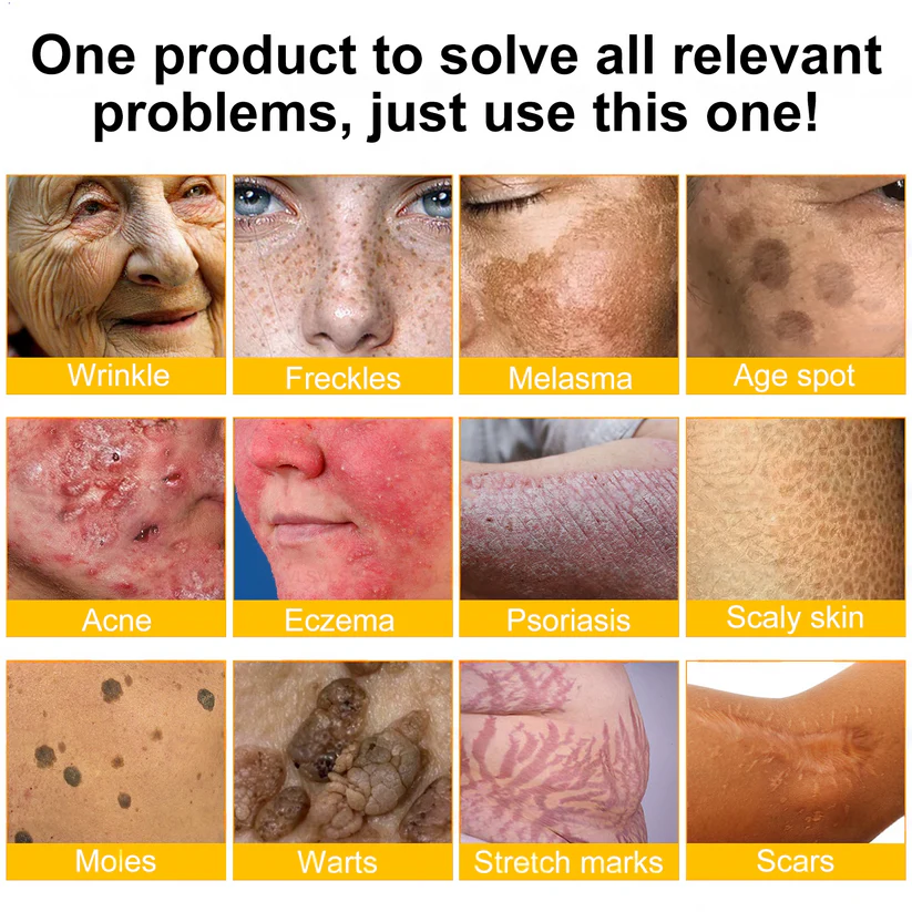 💐🌟💐Made and Shipped from USA ✨ LOVILDS™ Bee Venom Skin Restoration Cream 🔥 LAST DAY 80% OFF